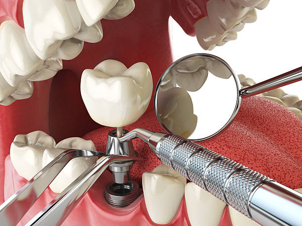 Best Urgent Dental Care for Toothaches in Leakesville, MS